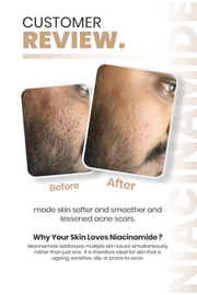 Niacinamide 10% Face Serum 30ml